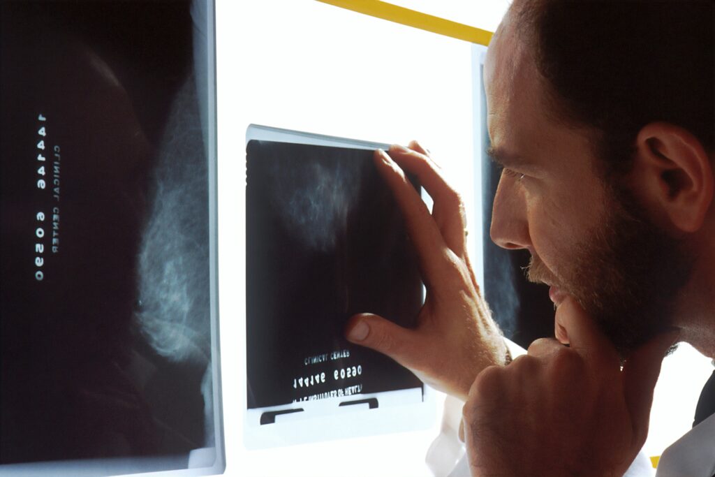 Medical Image Segmentation